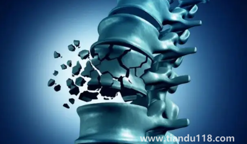 骨質(zhì)疏松癥也叫靜悄悄的流行病1